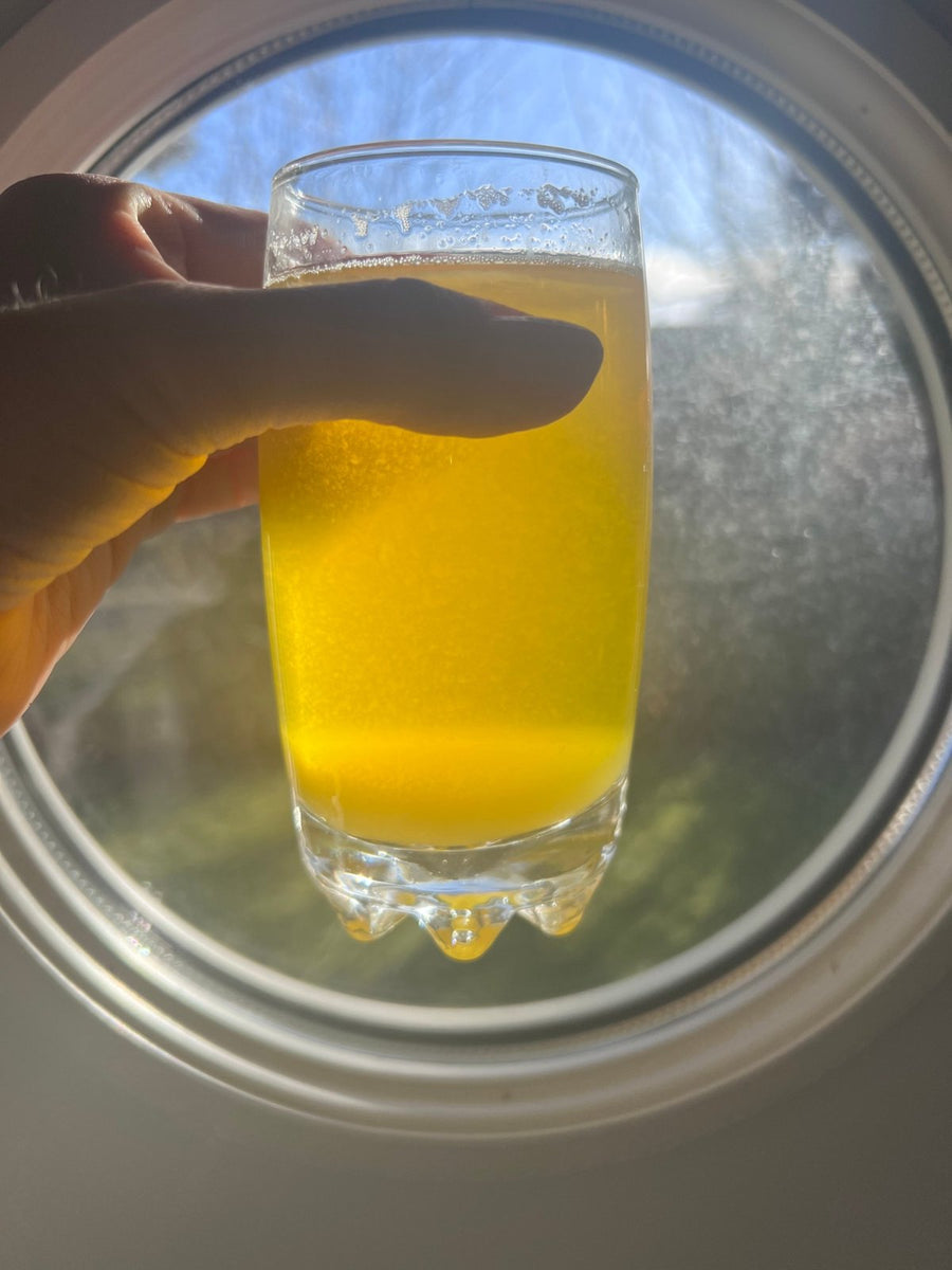 A glass of cloudy yellow urine held up against a window, with fine particles in suspension and a pale layer settling at the bottom